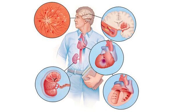 Danos a vários órgãos com hipertensão arterial prolongada