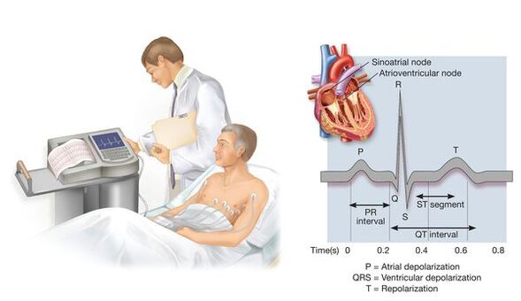 Eletrocardiografia para detectar doenças cardiovasculares com hipertensão